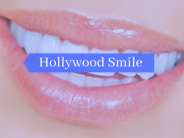 dental implants clinic in india
